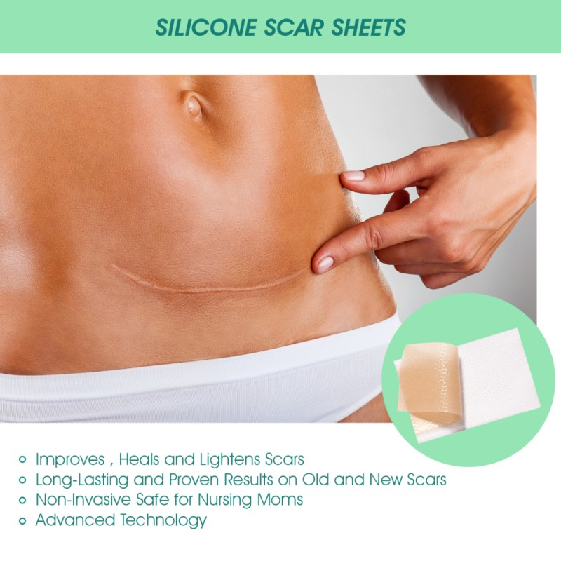 Silicone Scar Sheets Self-adhesive Scar Tape Scar Removal Strips For Acne Scars C-section Keloid Surgery Scars Treatment 4pcs/box Silicone Scar Sheets Self-adhesive Scar Tape Scar Removal Strips For Acne Scars C-section Keloid Surgery Scars Treatment 4pcs/box