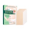 Silicone Scar Sheets Self-adhesive Scar Tape Scar Removal Strips For Acne Scars C-section Keloid Surgery Scars Treatment 4pcs/box